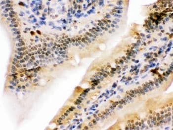 Polyclonal Rabbit anti-Human NIRF / UHRF2 Antibody (IHC, WB)