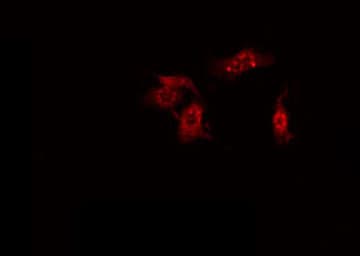 Polyclonal Rabbit anti-Human APOF / Apolipoprotein F Antibody (IF, WB)