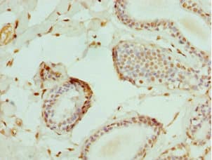 Polyclonal Rabbit anti-Human ELF1 Antibody (IHC)