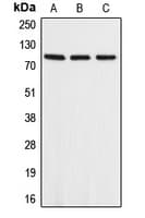 IHC-plus™ Polyclonal Rabbit anti-Human APLP2 Antibody (aa256-295, IHC, WB)