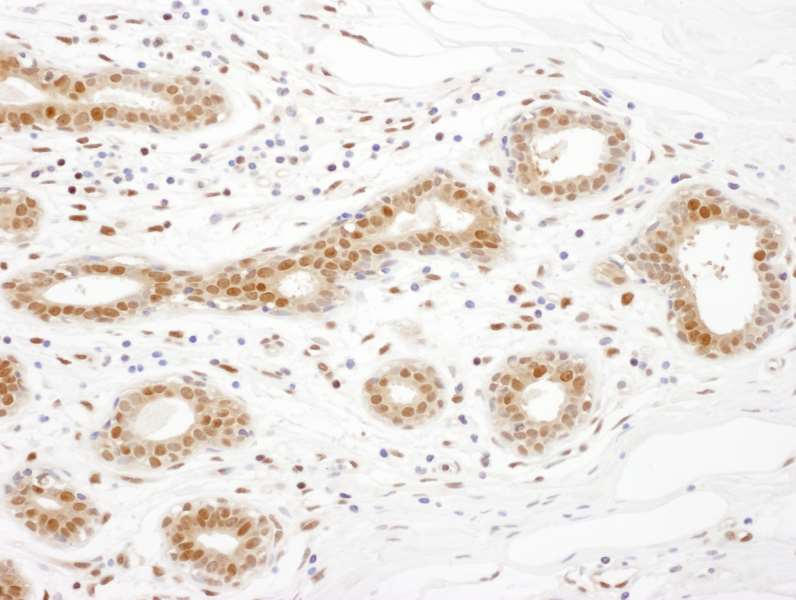 TSNAX / TRAX Antibody (aa240-290)