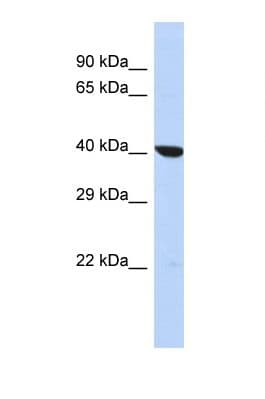 OXA1L / OXA1 Antibody (C-Terminus)