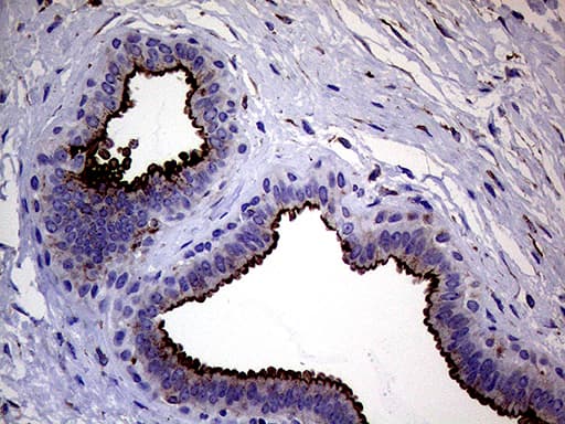 MLPH / Melanophilin Antibody (aa295-600, clone OTI6E3)