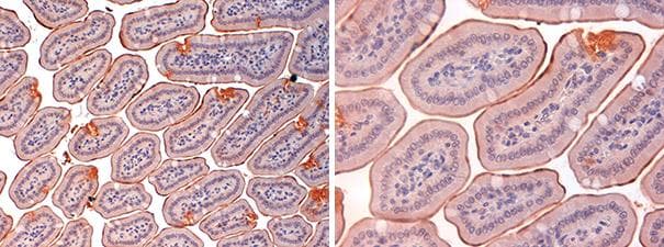 SLC2A5 / GLUT5 Antibody