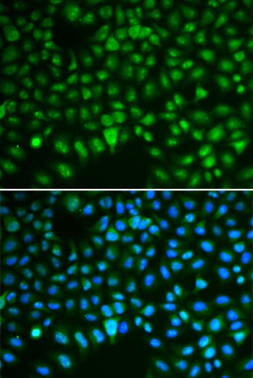 HURP / DLGAP5 Antibody