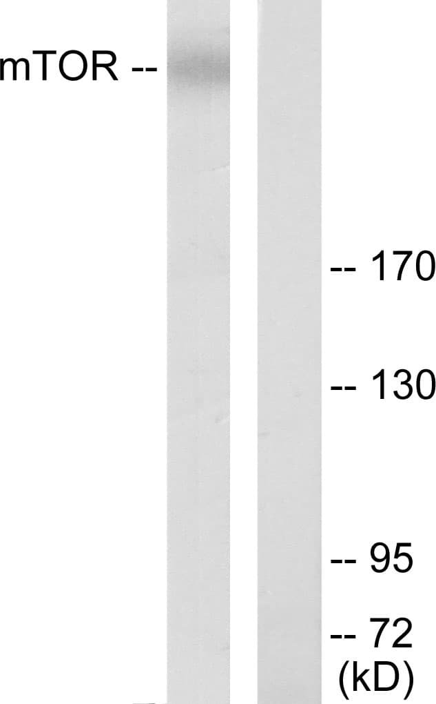 PathPlus™ Polyclonal Rabbit anti-Human MTOR Antibody (aa2415-2464, IHC, WB)