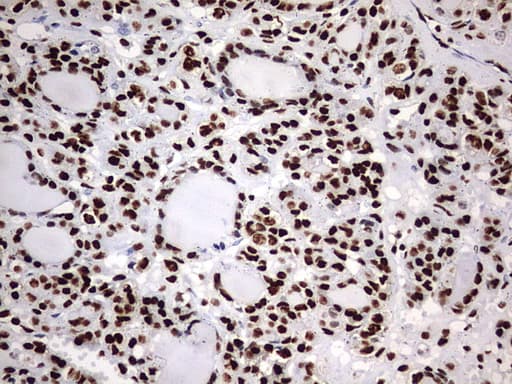 Monoclonal Mouse anti-Human HNRPM / HNRNPM Antibody (clone OTI1F6, aa1-261, IHC, WB)