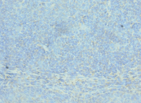 ACTR2 / ARP2 Antibody (aa1-160)