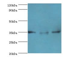 Polyclonal Rabbit anti-Human AIMP2 Antibody (aa141-320, IHC, WB)