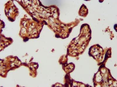 LMCD1 Antibody