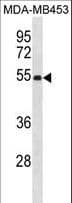 Polyclonal Rabbit anti-Human EIF2S2 Antibody (aa270-299, WB)