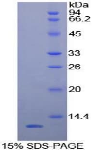 Human CCL5 / RANTES Protein (Recombinant His-T7)