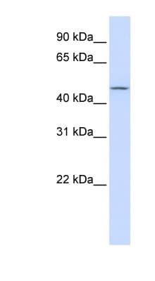 CHST6 Antibody (C-Terminus)