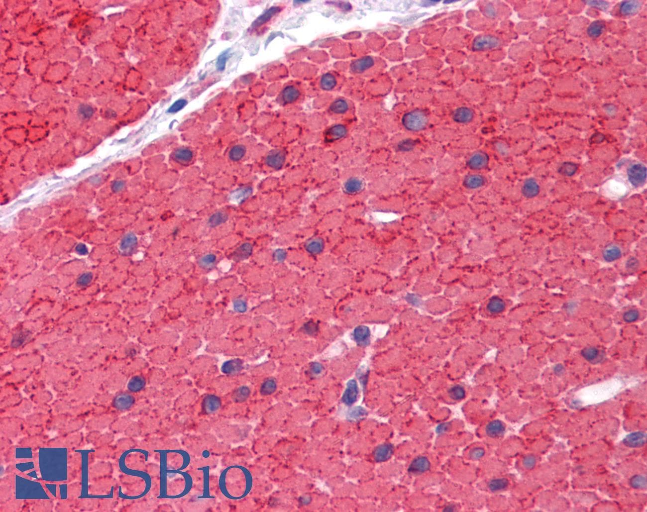 IHC-plus™ ARH / LDLRAP1 Antibody (clone 4G4-D5)