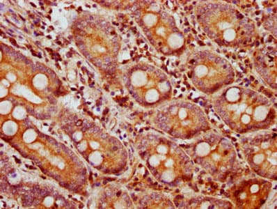 BMP2 Antibody