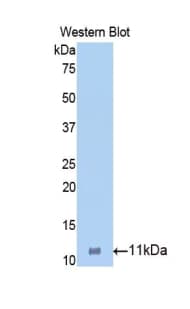 HP / Haptoglobin Antibody (aa21-98)