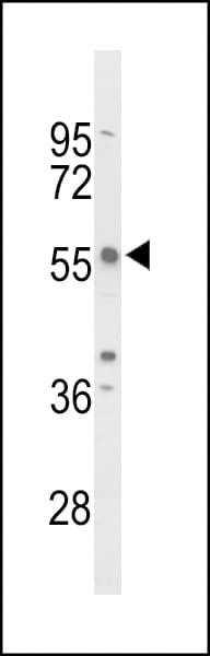 TC2N Antibody (aa3-30)