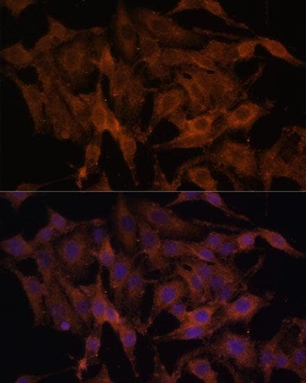 TLR3 Antibody