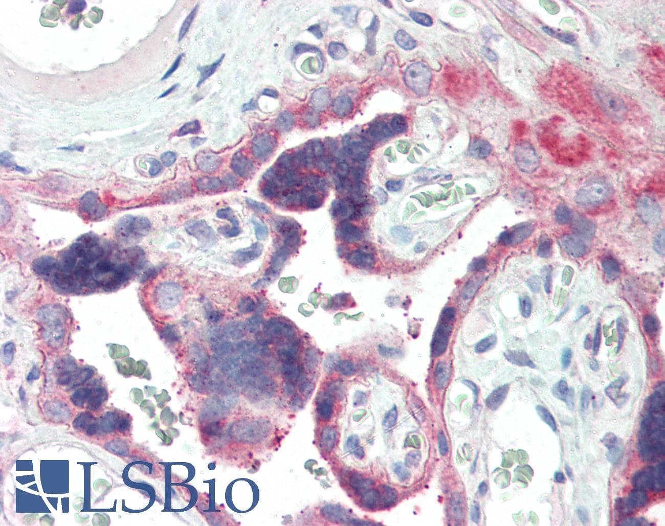 IHC-plus™ IRAK2 / IRAK-2 Antibody