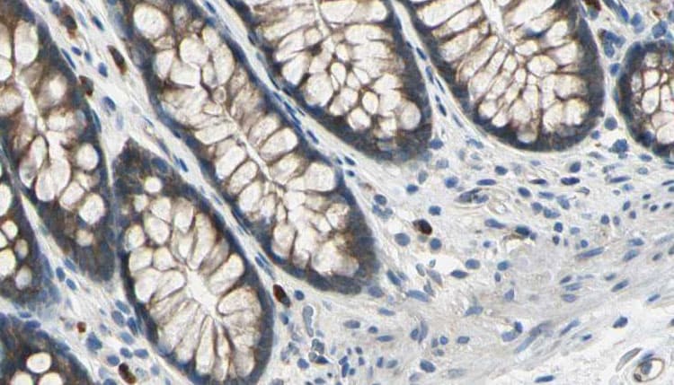 DIAPH3 / MDIA2 Antibody