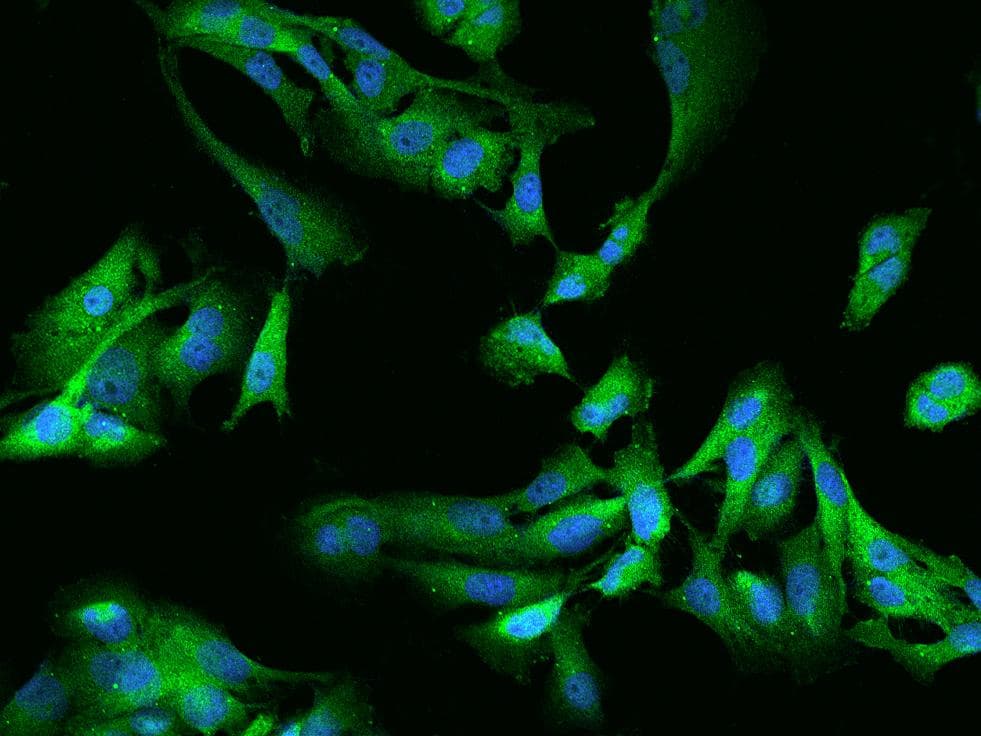 Polyclonal Rabbit anti-Human GSK3A / GSK3 Alpha Antibody (IF)