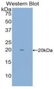 IFN Gamma / Interferon Gamma Antibody (aa24-167)