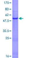 Human IFNA8 / Interferon Alpha 8 Protein (Recombinant GST)