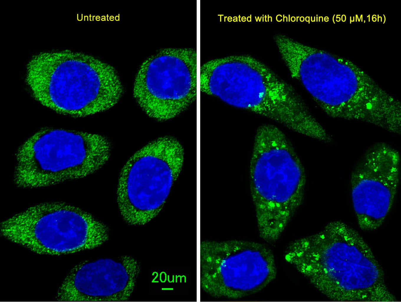 ATG16L1 / ATG16L Antibody (aa161-190)