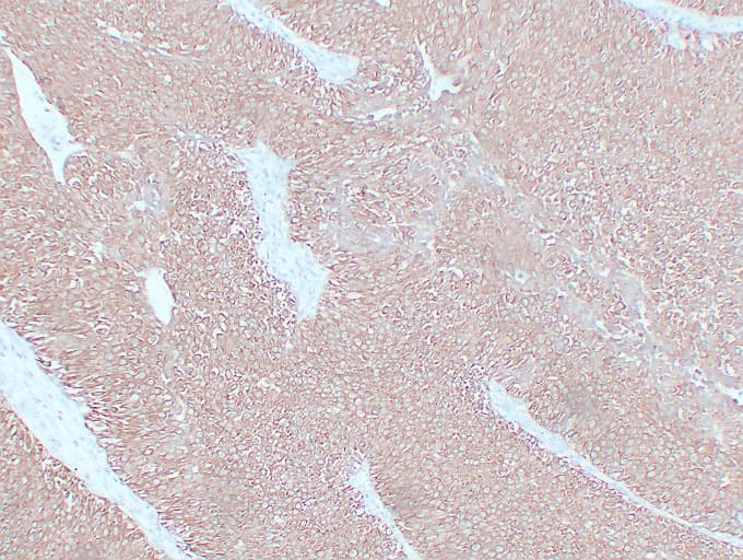 IHC-plus™ Monoclonal Mouse anti-Human KRT7 / CK7 / Cytokeratin 7 Antibody (clone ABT-CK7, IHC, WB)