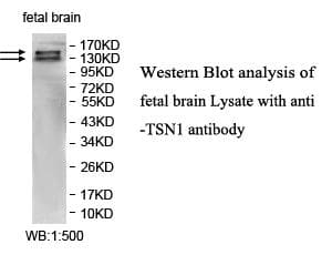 Polyclonal Rabbit anti-Human ITSN1 / ITSN Antibody (aa646-840, WB)