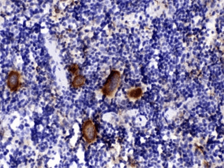 CXCL4 / PF4 Antibody