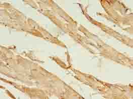 ACS5 / ACSL5 Antibody