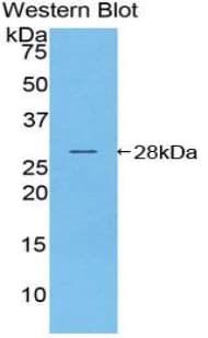 NOD1 Antibody (aa612-826)