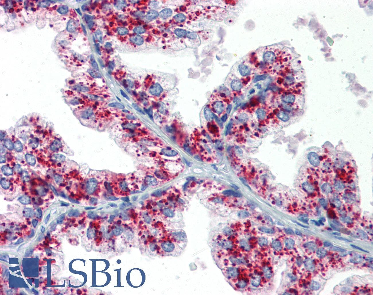 IHC-plus™ Monoclonal Mouse anti-Human ASAH1 / Acid Ceramidase Antibody (clone 1A7, IHC, WB)