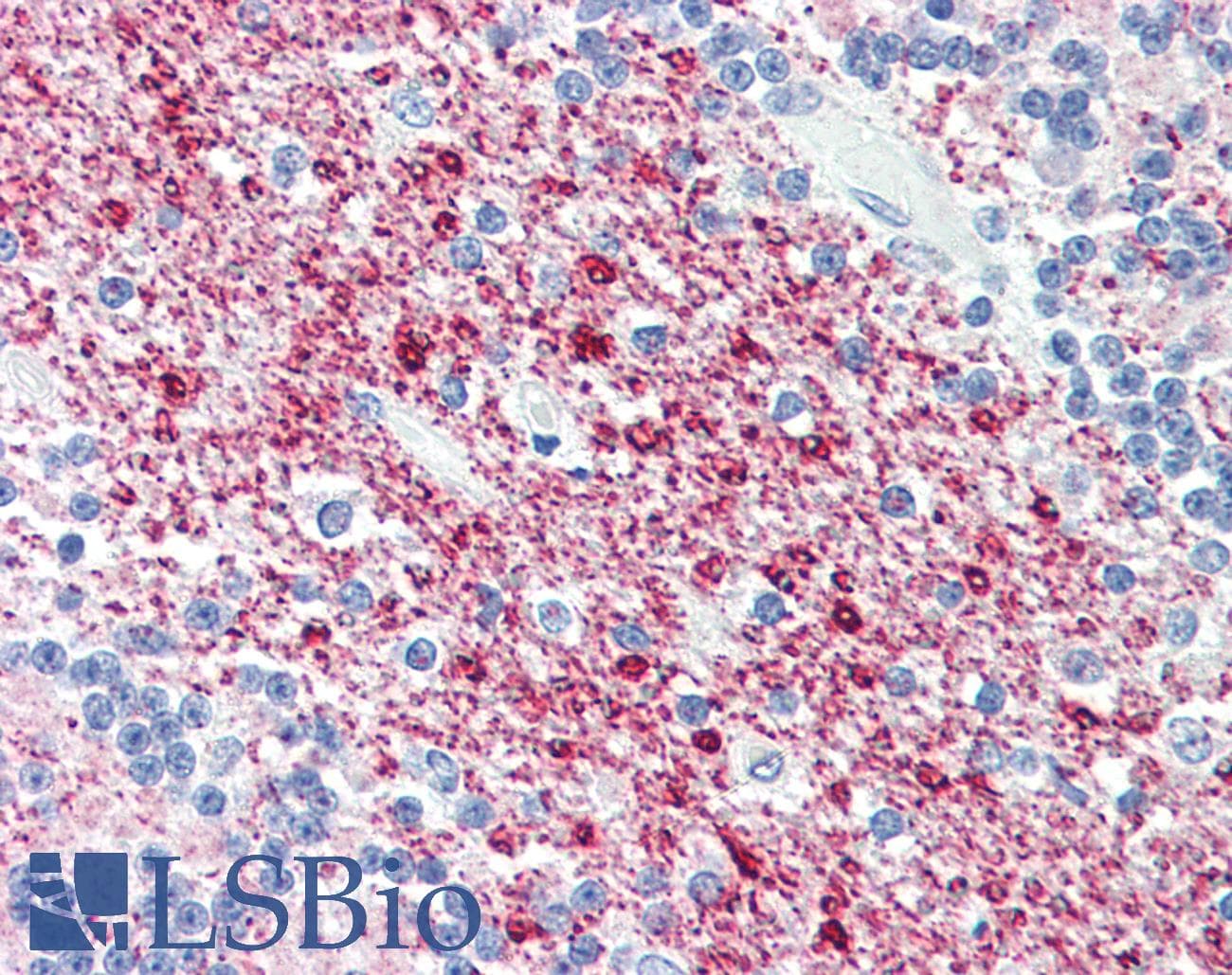IHC-plus™ SIRT2 / Sirtuin 2 Antibody