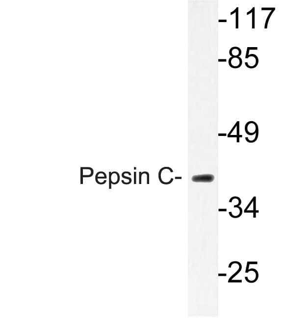 PGC / Pepsin C Antibody (Phe306)