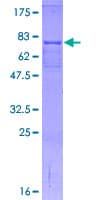 Human CETP Protein (Recombinant GST)