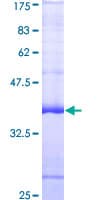 Human FRK Protein (Recombinant GST, N-terminus)