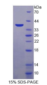 Human TRPA1 Protein (Recombinant His-T7)