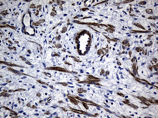 Monoclonal Mouse anti-Human MLC3F / MYL1 Antibody (clone OTI1H3, aa2-150, IHC, WB)