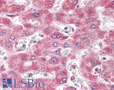 IHC-plus™ Polyclonal Rabbit anti-Human SCN9A / Nav1.7 Antibody (IHC)