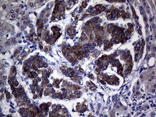 NDUFAF5 Antibody (clone OTI6A9)