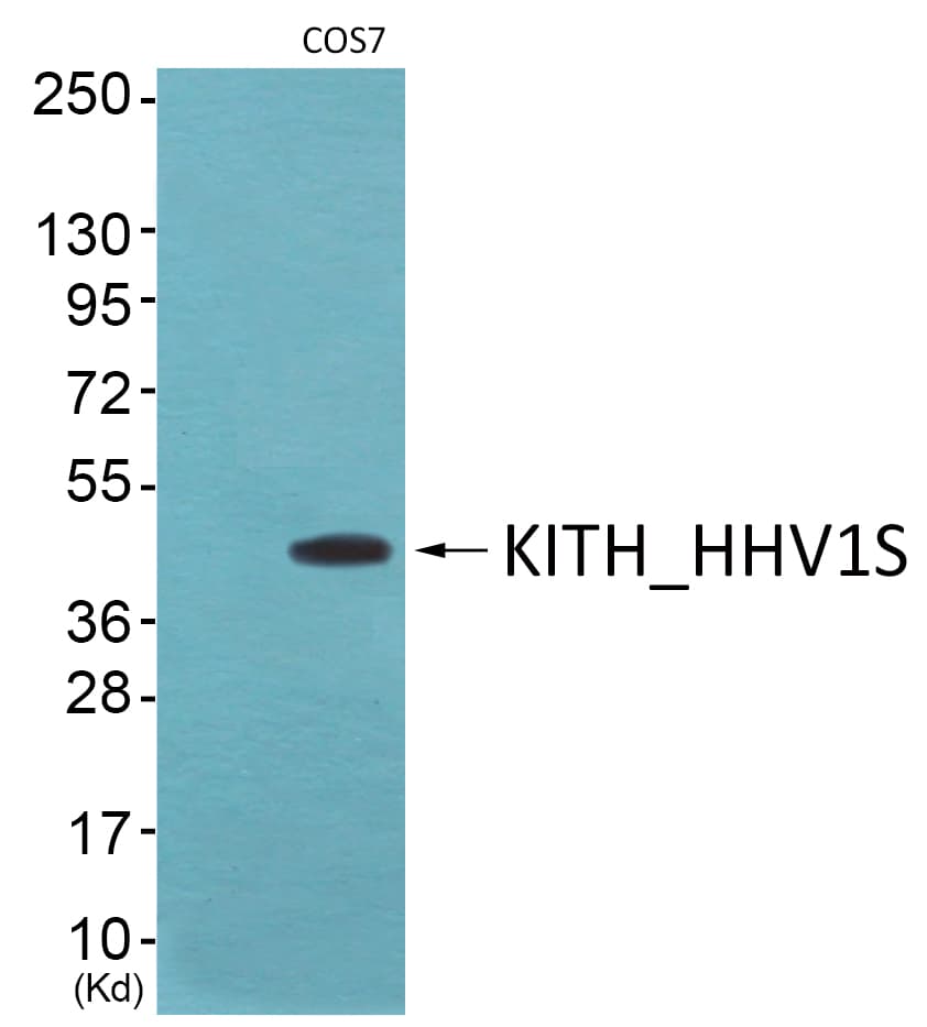 HSV-TK Antibody