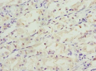 C1GALT1C1 Antibody