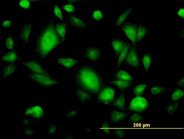Monoclonal Mouse anti-Human GNB3 Antibody (clone M1-1-1D5, IF, WB)