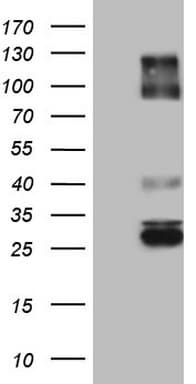 IGSF11 / VSIG3 Antibody (aa23-241, clone OTI3D2)