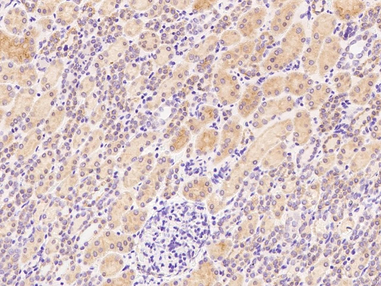 Polyclonal Rabbit anti-Human STARD4 Antibody (Preservative Free, IHC)