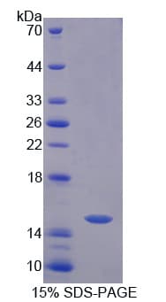 Human CRTC3 Protein (Recombinant His-T7)