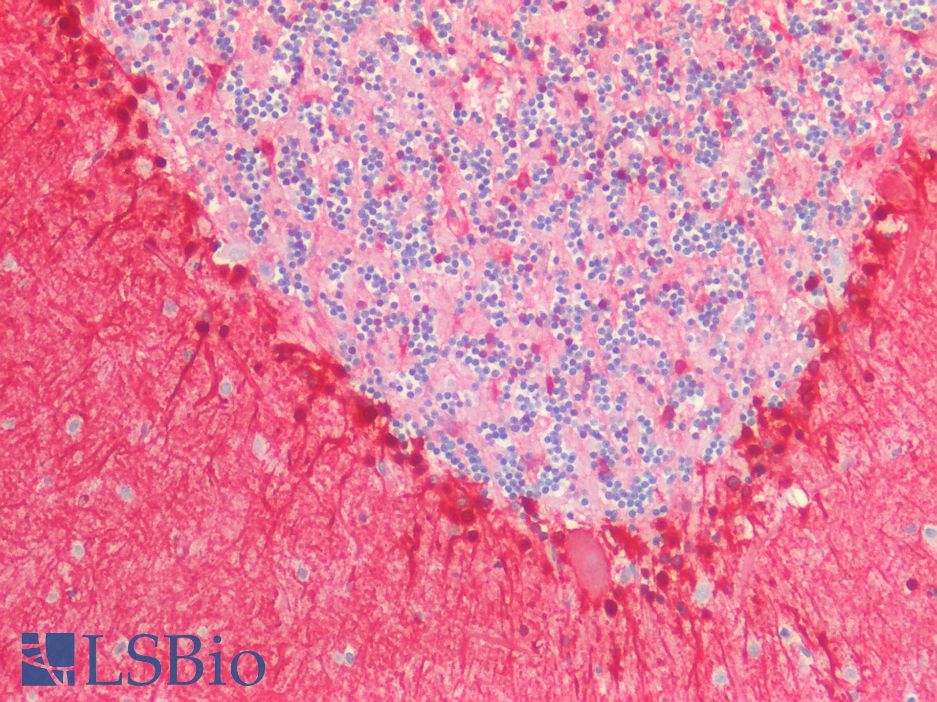 PathPlus™ Monoclonal Mouse anti-Human ALDH1A1 / ALDH1 Antibody (clone 5A11, IHC, WB)