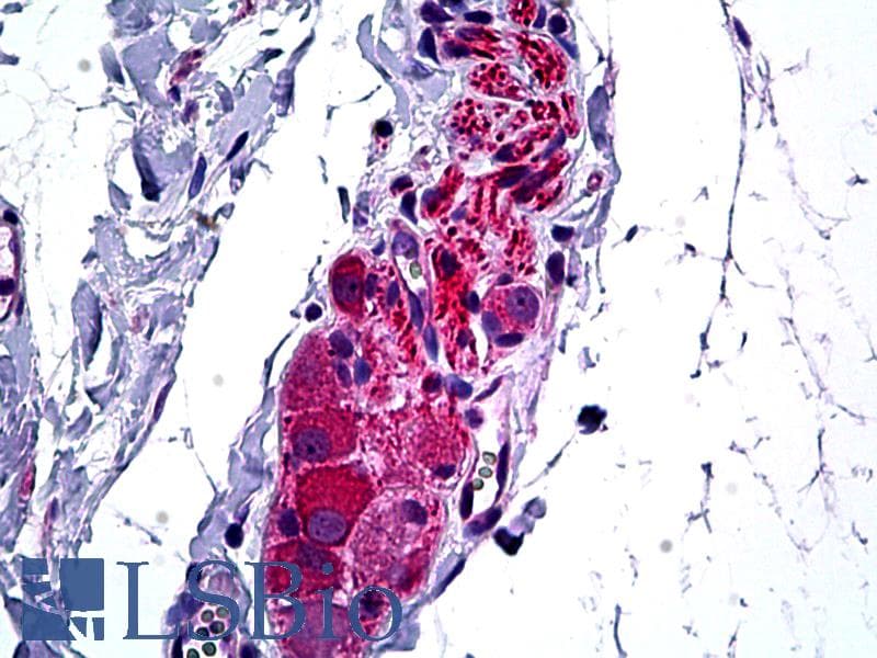 IHC-plus™ HDAC6 Antibody (aa7-56)